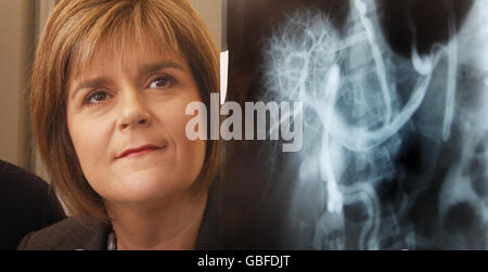 Nicola Sturgeon, secrétaire à la Santé, avec une radiographie montrant un foie endommagé, lors d'une visite à l'infirmerie royale de Glasgow pour marquer la publication de la nouvelle stratégie du gouvernement écossais pour s'attaquer aux problèmes d'alcool. Banque D'Images