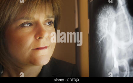 Nicola Sturgeon, secrétaire à la Santé, avec une radiographie montrant un foie endommagé, lors d'une visite à l'infirmerie royale de Glasgow pour marquer la publication de la nouvelle stratégie du gouvernement écossais pour s'attaquer aux problèmes d'alcool. Banque D'Images