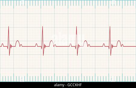 Moniteur cardiaque médical taux de pulsation de mesure avec un fond blanc. Illustration vecteur EPS 10 Illustration de Vecteur