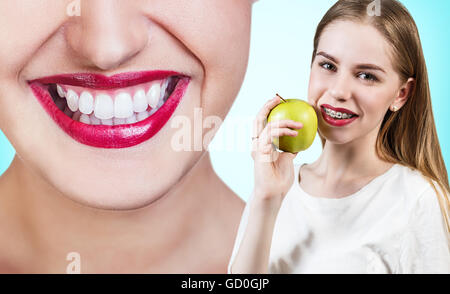 Jeune femme avec des crochets sur les dents eating apple Banque D'Images