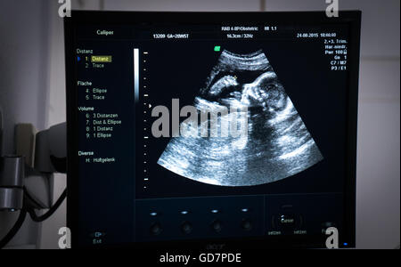 Échographie obstétricale de foetus Banque D'Images