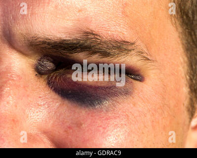 Close up of a Black eye Banque D'Images