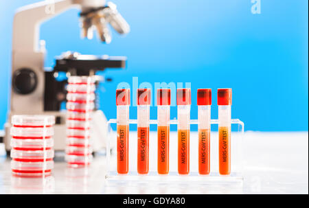 Test sanguin pour la présence de coronavirus du syndrome respiratoire du Moyen-Orient (MERS-CoV) Banque D'Images