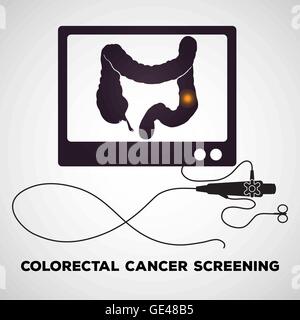 Procédure de la coloscopie pour le dépistage des maladies du colon Illustration de Vecteur