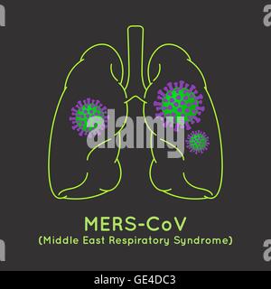 MERS-CoV(coronavirus du syndrome respiratoire du Moyen-Orient) illustration de l'image Illustration de Vecteur