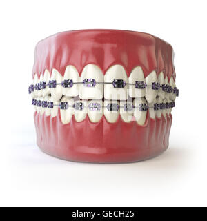 Dents avec accolades ou crochets isolé sur blanc. Concept de soins dentaires. 3d illustration Banque D'Images
