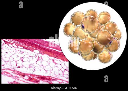 Les cellules adipeuses, lumière microphotographie et illustration de l'ordinateur. Le tissu adipeux blanc composé d'adipocytes (cellules graisseuses). Forme les adipocytes du tissu adipeux, qui stocke l'énergie comme une couche isolante de graisse. Le tissu adipeux blanc est utilisé comme réserve d'énergie mais aussi un Banque D'Images