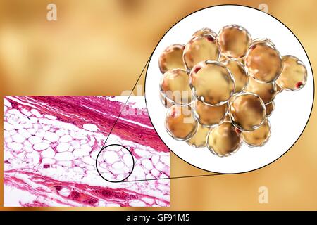 Les cellules adipeuses, lumière microphotographie et illustration de l'ordinateur. Le tissu adipeux blanc composé d'adipocytes (cellules graisseuses). Forme les adipocytes du tissu adipeux, qui stocke l'énergie comme une couche isolante de graisse. Le tissu adipeux blanc est utilisé comme réserve d'énergie mais aussi un Banque D'Images