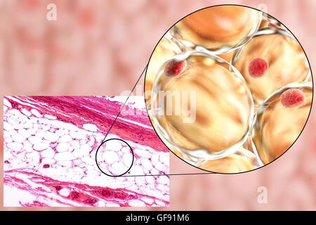 Les cellules adipeuses, lumière microphotographie et illustration de l'ordinateur. Le tissu adipeux blanc composé d'adipocytes (cellules graisseuses). Forme les adipocytes du tissu adipeux, qui stocke l'énergie comme une couche isolante de graisse. Le tissu adipeux blanc est utilisé comme réserve d'énergie mais aussi un Banque D'Images