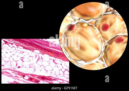 Les cellules adipeuses, lumière microphotographie et illustration de l'ordinateur. Le tissu adipeux blanc composé d'adipocytes (cellules graisseuses). Forme les adipocytes du tissu adipeux, qui stocke l'énergie comme une couche isolante de graisse. Le tissu adipeux blanc est utilisé comme réserve d'énergie mais aussi un Banque D'Images