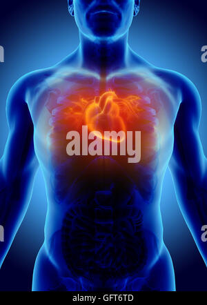 3D illustration de l'insuffisance cardiaque - partie des droits de l'organique. Banque D'Images