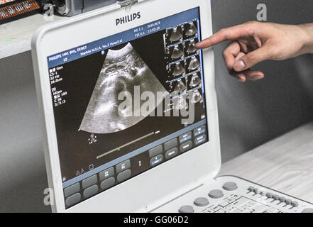 Harbin. 2 Août, 2016. Photo prise le 2 août 2016 montre B-scan image d'un foetus de lions de mer dans l'examen d'une femme enceinte à Harbin Polarland de lions de mer dans la région de Harbin, capitale de la province du nord-est de la Chine. Harbin Polarland invité un médecin du ministère de l'échographie de l'hôpital n°2 affilié à l'Université de médecine de Harbin pour examiner l'otarie, qui devrait offrir un bébé à la fin du mois d'août. Credit : Wang Song/Xinhua/Alamy Live News Banque D'Images