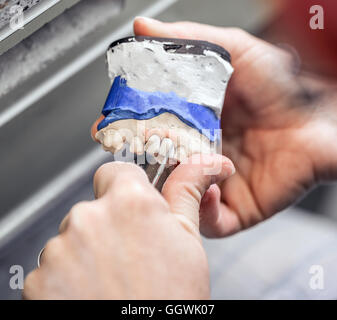 Main femme faire avec l'outil de prothèse Banque D'Images