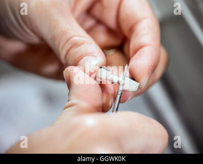 Prothèses dentaires technicien travaillant sur Banque D'Images