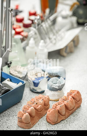 Photos de techniques sur un modèle de laboratoire de prothèse dentaire Banque D'Images