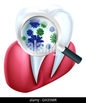 Un medical dental illustration d'une dent et la gencive couverts dans les bactéries vu à travers une loupe Banque D'Images