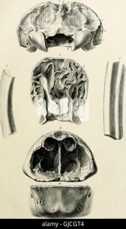 Ce travail décrit le squelette du paresseux géant éteint, Mylodon robustus, découvert par Richard Owen en 1842. Il comprend des observations détaillées sur les caractéristiques des quadrupèdes méga-ïdes, offrant un aperçu des créatures préhistoriques qui parcouraient autrefois la Terre. Banque D'Images