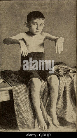 Un traité sur les maladies nerveuses des enfants, pour les médecins et les étudiants (1905) Banque D'Images
