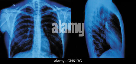 X-ray Banque D'Images