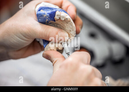 Technicien travaillant sur le dentier Banque D'Images