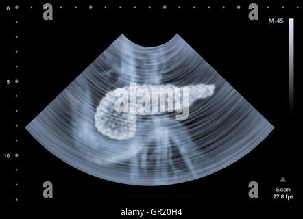Échographie du pancréas humain. Illustration Banque D'Images