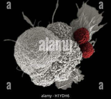 Les lymphocytes T et les cellules du cancer, couleur de l'analyse des électrons Microphotographie (SEM) . Banque D'Images