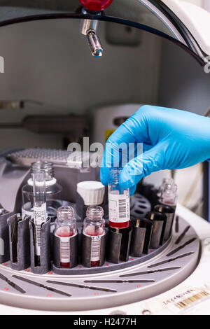 Des échantillons de sang dans des flacons sur une machine centrifuge. Banque D'Images