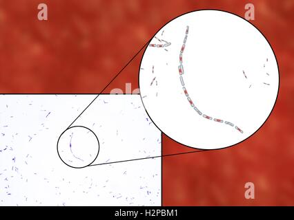 La bactérie du charbon, de la lumière et de l'informatique micrographie illustration. La bactérie du charbon (Bacillus anthracis) sont la cause de la maladie de l'anthrax dans l'homme et le bétail. Ils sont Gram positif bactéries productrices de spores disposées en chaînes (streptobacilli). De nombreuses cellules ont un spore (rouge). Banque D'Images