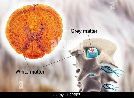 La moelle épinière, cross-section. Microphotographie lumière illustration d'un ordinateur et de la moelle épinière. À droite, il est visible à l'intérieur de l'os (vertèbres). La section à gauche montre la matière grise et blanche avec des cornes dorsales et ventrales. Banque D'Images
