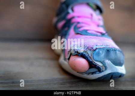 Vieilles chaussures avec des trous pour les sans-abri miteux usé orteils qui sort de l'habillement Banque D'Images