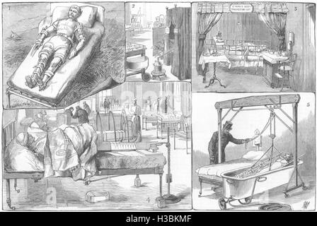 Les hôpitaux Extempore;vinaigrette Ward kit tente Guy's,St Mary's;Baignoire ascenseur Mddx 1881. Le graphique Banque D'Images