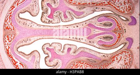 Les sinus nasaux. La lumière microphotographie (LM) des sinus nasaux ( bordée par un épithélium marron ) et les cartilages (rose). Le tissu osseux est identifié par la la moelle rouge. Grossissement : x4 lors de l'impression à 10 centimètres de large. Banque D'Images