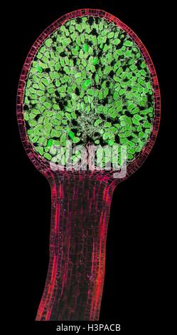 Des spores de l'hépatique capsule. La lumière microphotographie (LM). Section longitudinale à travers le thalle d'un sporange et l'hépatique (Pellia epiphylla). Le sporange (spore capsule, centre supérieur) est inclus dans le cas du thalle (calyptra). Le sporange est dense avec des spores sphériques (vert), qui sont emportés par les courants d'air lorsque le sporange se fractionne. Grossissement : x20 lors de l'impression à 10 centimètres de large. Banque D'Images