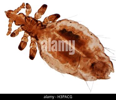 Les poux de tête, léger microraph (LM) 0f Pediculus humanus capitis. P. humanus est divisé en deux sous-espèces ; les poux de tête P. humanus capitis et le corps pou principal P. humanus corporis. Le pou du corps vit en vêtements et se déplace uniquement sur la peau de manger, alors que le pou principal se limite à la chevelure de la tête. Malgré cette différence dans l'habitat, les deux poux ne diffèrent que légèrement en forme et sont capables de croisement. Colle les poux de tête de leurs œufs (lentes) à poils, tandis que le corps utilise principalement pou les plis des vêtements dans les coutures. Grossissement : x25 lors de l'impression de 10 cm de largeur. Banque D'Images