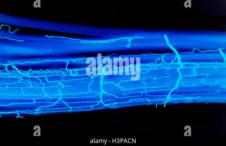 L'approvisionnement de sang aux muscles. La lumière microphotographie (LM) montrant l'apport sanguin dans les fibres musculaires. Les fibres musculaires (bleu) ont été taquiné en dehors de révéler le lit capillaire (cyan) qui a été perfusé avec du colorant. Chaque fibre musculaire possède son propre réseau capillaire fin ramifiées en profondeur l'entourant. Les capillaires sont les plus petits vaisseaux sanguins dans le corps. Ils ont des parois fines qui permettent aux éléments nutritifs dissous et l'oxygène de passer dans les cellules musculaires. Les muscles squelettiques sont sous contrôle volontaire et déplacer les os du squelette. Agrandissement : x800 lors de l'impression de 10 cm de largeur. Banque D'Images