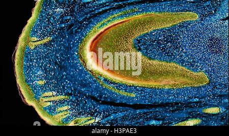 L'élaboration d'ongle. La lumière microphotographie (LM) de section longitudinale à travers le bout de doigt pour montrer l'élaboration d'ongle. La grande surface du lit unguéal vert-jaune est inclinée, l'épithélium par les clous. Tissu conjonctif bleu (derme) constitue l'essentiel de l'image. Épithélium pavimenteux stratifié jaune de la peau est l'extrême gauche. Grossissement : x15 lors de l'impression à 10 centimètres de large. Banque D'Images