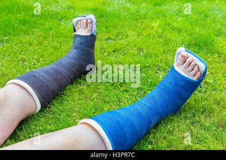 Deux jambes de gypse de l'enfant sur l'herbe Banque D'Images