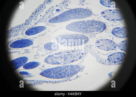 Vue microscopique de la méiose sauterelle Banque D'Images