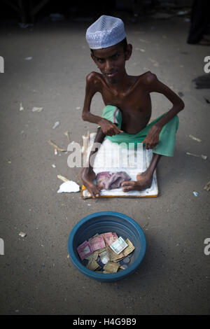 Dhaka, Bangladesh. 15 octobre, 2016. Sohel age de 23 ans un patient typhoïde pose sur street Dhaka, Bangladesh, le 15 octobre 2016. Sohel age de 23 ans d'Chadpur district a affecté par la typhoïde il y a 8 ans et maintenant il est devenu boiteux par cette maladie. Zakir Hossain Chowdhury Crédit : zakir/Alamy Live News Banque D'Images