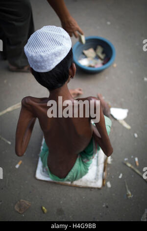Dhaka, Bangladesh. 15 octobre, 2016. Sohel age de 23 ans un patient typhoïde pose sur street Dhaka, Bangladesh, le 15 octobre 2016. Sohel age de 23 ans d'Chadpur district a affecté par la typhoïde il y a 8 ans et maintenant il est devenu boiteux par cette maladie. Zakir Hossain Chowdhury Crédit : zakir/Alamy Live News Banque D'Images