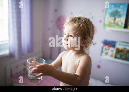 Petite fille avec la varicelle, crème antiseptique appliqué à l'éruption. Banque D'Images