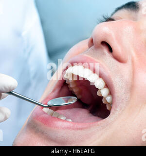 Close up macro de jeune homme avec la bouche ouverte montrant les dents blanches en bonne santé. Dentiste part contrôler les dents avec miroir de la bouche. Banque D'Images