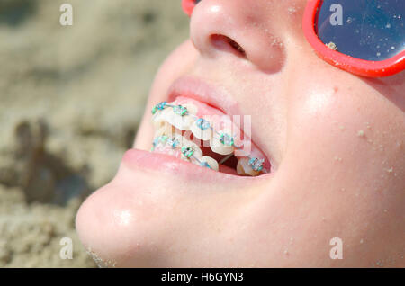 Jeune femme avec des crochets sur les dents, Close up shot Banque D'Images