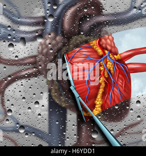Les maladies du cœur humain comme une thérapie de la santé cardiaque et cardiovasculaire concept médical avec un balais d'essuyer et retrait d'un malade en cure d'organes floue et symbole de traitement ou le chirurgien cardiologue avec 3D illustration éléments. Banque D'Images