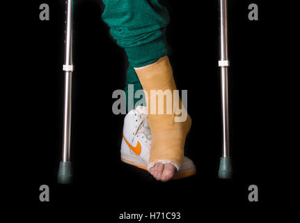 NEW YORK - Mai 18, 2016 : Jeune homme avec une cheville cassée et une orange moulé sur sa jambe à la suite d'un accident de basket-ball, randonnée pédestre sur Banque D'Images