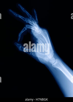 X-ray de part faire symbole OK Banque D'Images