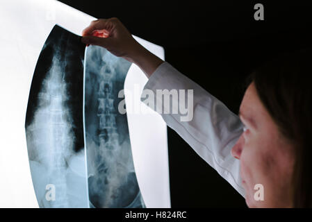 Female doctor examining x-ray rachis à l'hôpital, bureau professionnel en uniforme blanc de l'analyse de l'image d'examen préalable type Banque D'Images