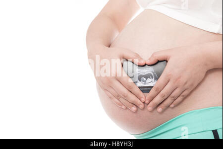 Femme enceinte asiatique montrent à l'échographie bébé sur fond blanc Banque D'Images