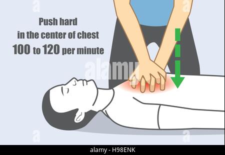 Part pousser fort et rapide dans le centre de la poitrine 100 à 120 par minute. Illustration de Vecteur