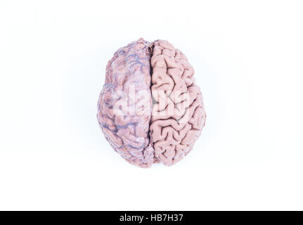 L'hémisphère gauche du cerveau humain Photo Stock - Alamy